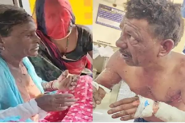 चाय बनाते हए मां-बेटे दोनों झुलसे