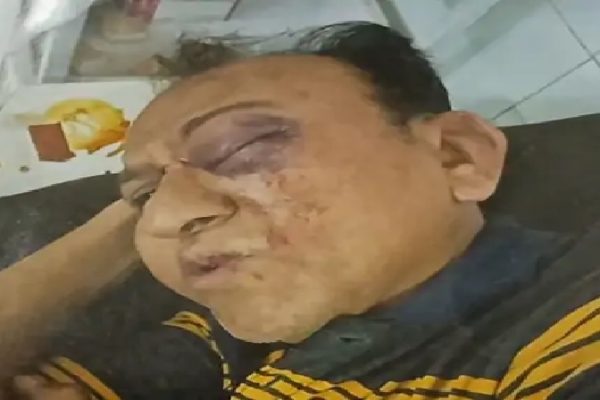भाजपा MLA पर डॉक्टर की किडनैपिंग-मारपीट का केस