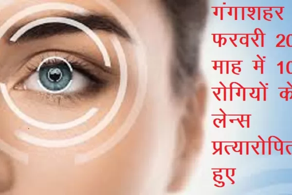 फरवरी 2025 माह में 103 रोगियों के लेन्स प्रत्यारोपित हुए