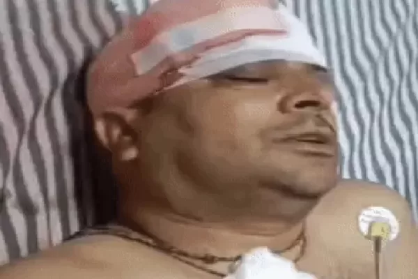सरपंच को लाठी-डंडों से पीटा, हाथ-पैर तोड़े